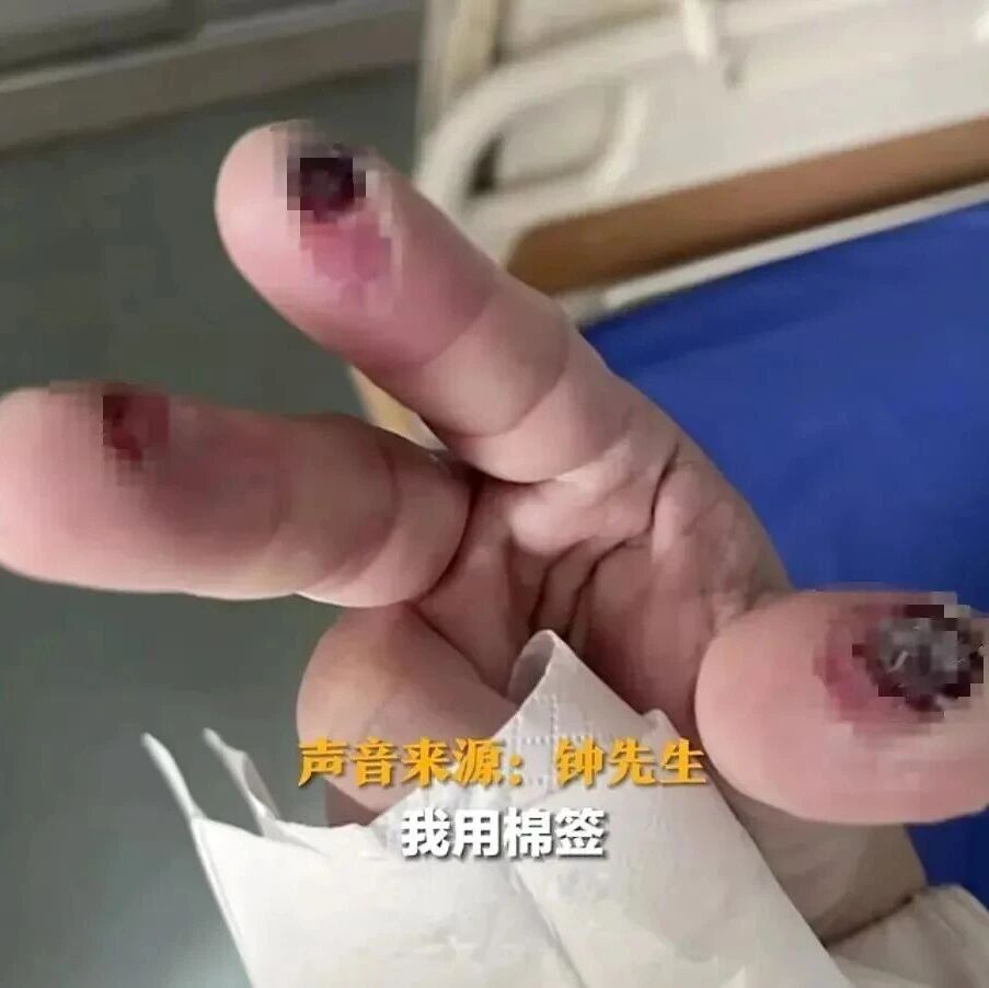 【微靖江】警惕清洁剂中隐藏的“化骨水”!你家可能也有→